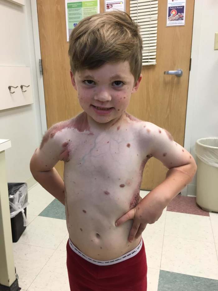 Dylan smiling for the camera as a young boy in a doctor's office, Photo Credit: Facebook/Dylan's Amazing Journey