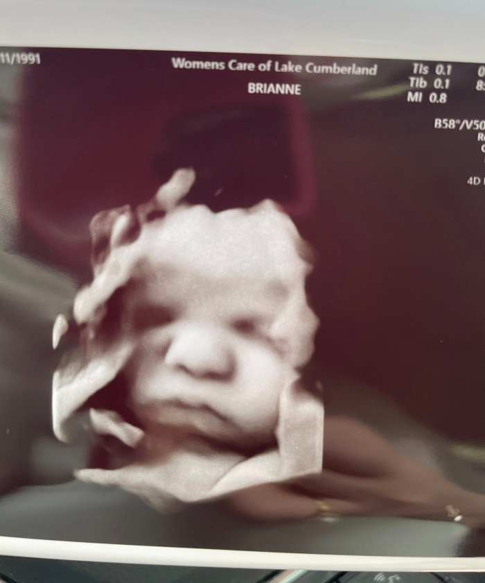 Ultrasound of a baby boy at 36 weeks, Photo Credit: Amanda Foster/Facebook