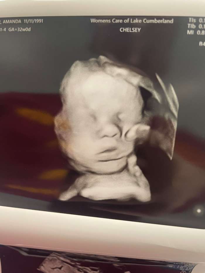 Ultrasound of a baby boy with what looks like a hand holding his head, Photo Credit: Amanda Foster/Facebook
