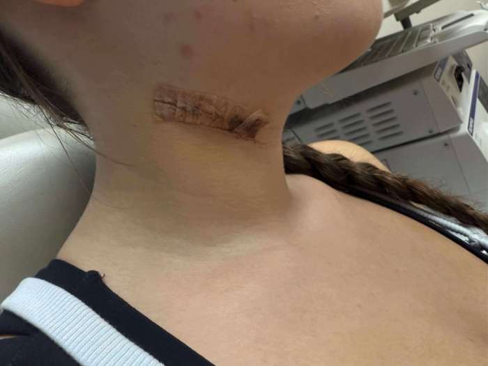 Jesse Butler's victim with a visible injury on her neck, Photo Credit: Justinthenickofcrime/Facebook
