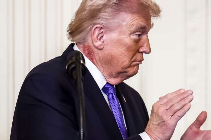 President Donald Trump with a visible neck rash at White House Medal of Honor Ceremony, Photo Credit: News Reader Cat NO DMs/X