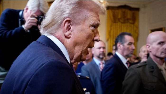 President Donald Trump with a visible neck rash, Photo Credit: Falling for a Girl Who Won't Listen/X