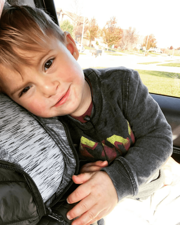 Brody looking at the camera after a surgery to fix his cleft lip, Photo Credit: Instagram/Saheller