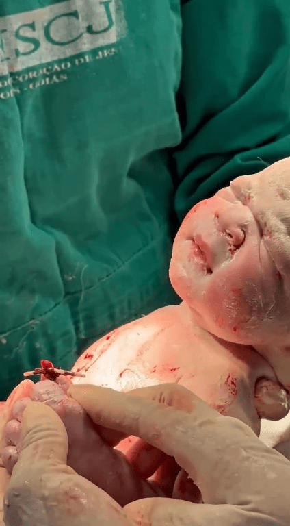 A newborn baby holding an IUD in his hands, Photo Credit: Governo de Goiás/X