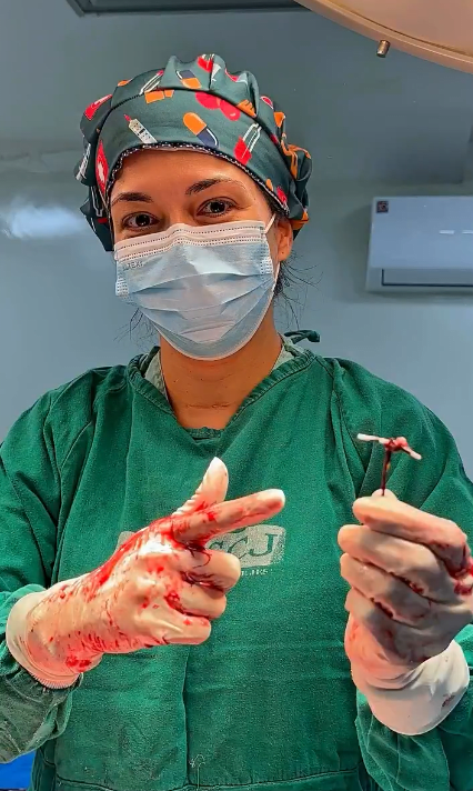 Dr Natalia Rodrigues holding an IUD after delivering a baby, Photo Credit: Governo de Goiás/X