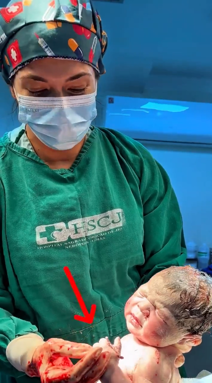 A newborn baby holding an IUD in his hands, Photo Credit: Governo de Goiás/X