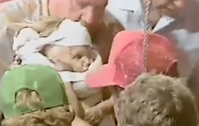 Baby Jessica after she was rescued from a deep well in 1987, Photo Credit: People/Youtube