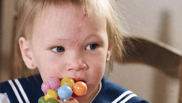 Baby Jessica with healed wounds on her head, Photo Credit: People/Youtube