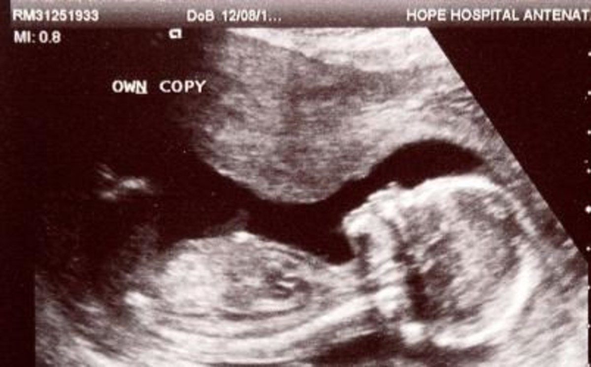 doctor gives woman abortion pill fails to realize mistake until