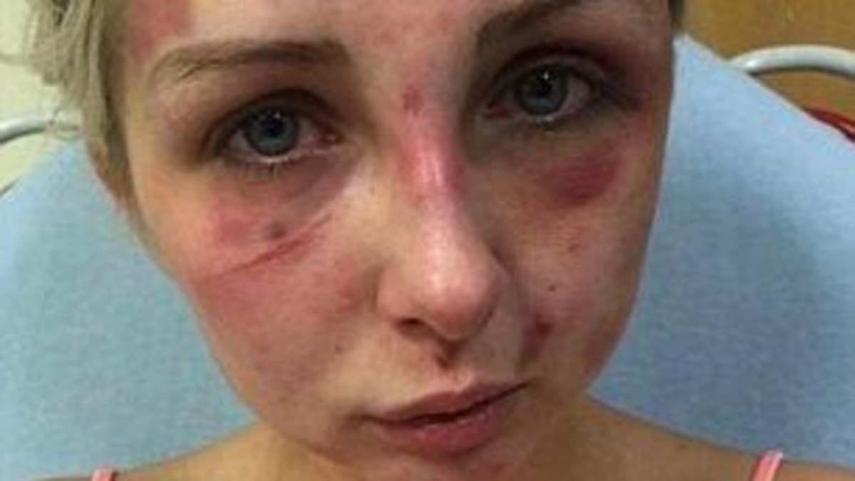 Authorities Outraged At Man s Excuse For Why He Beat His 