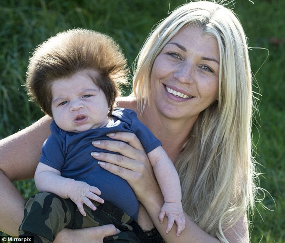 9 Week Old Baby Grows Bouffant Hair Photos Opposing Views