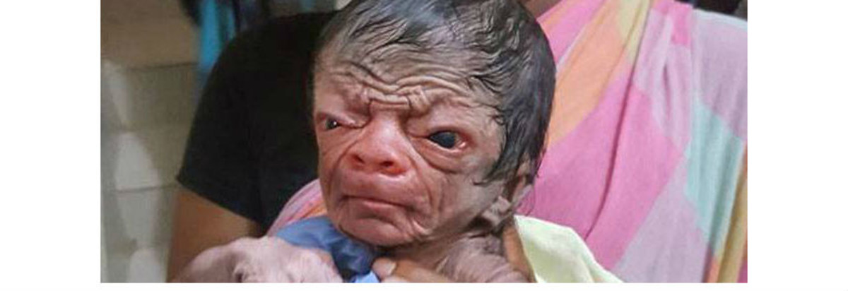 Unusually Hairy Newborn Baby Looks 80 (Video) Opposing Views