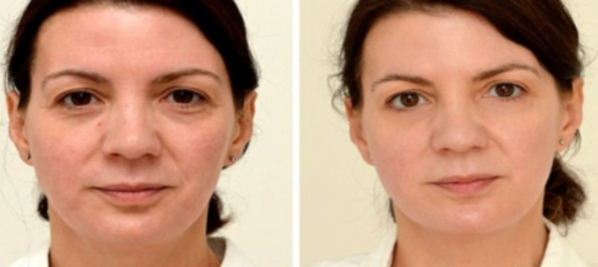 Woman's Experiment With Drinking A Gallon Of Water A Day