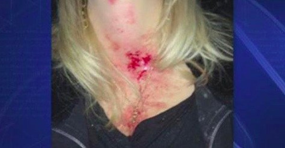 Woman Warns Other Drivers After Ride Home Takes Scary Turn Promo Image