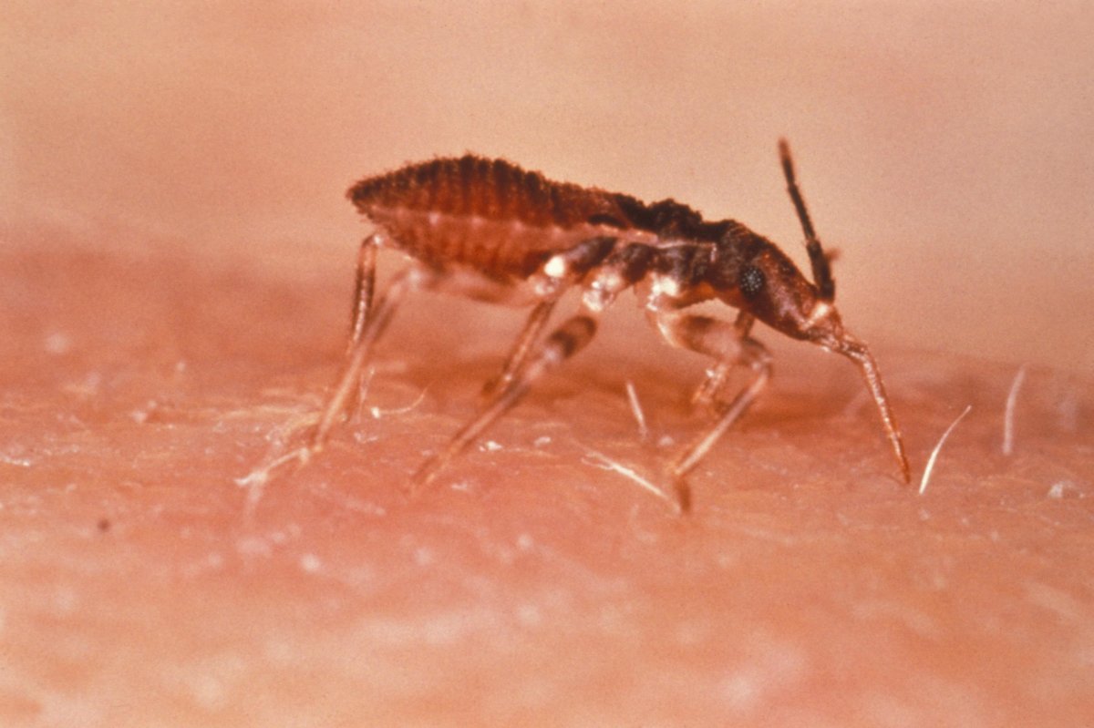 Experts Warn Of Bug That Can Cause Chagas Disease Promo Image