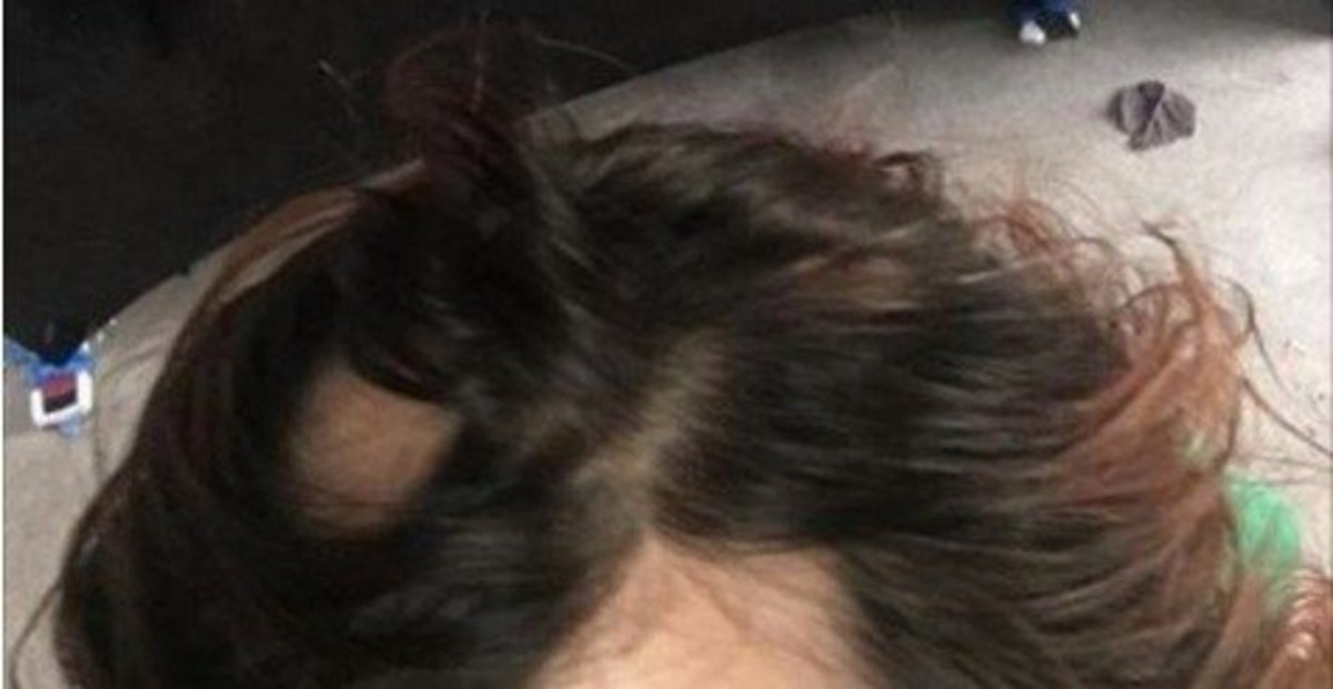 Hundreds Of Women Claim This Best Selling Shampoo Caused Horrific