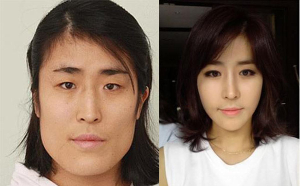 Korean Woman Gets New Face and a Fiancé Thanks To Amazing