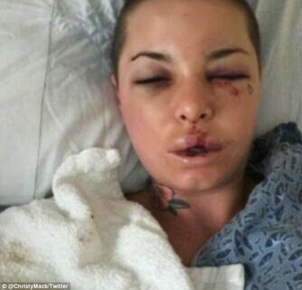 Christy Mack Beat Up Christy Mack Beat Up
