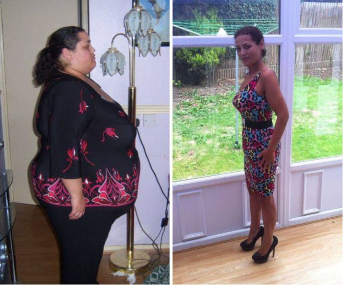 How One Woman Rejected Weight Loss Surgery And Lost 280 Pounds On Her 