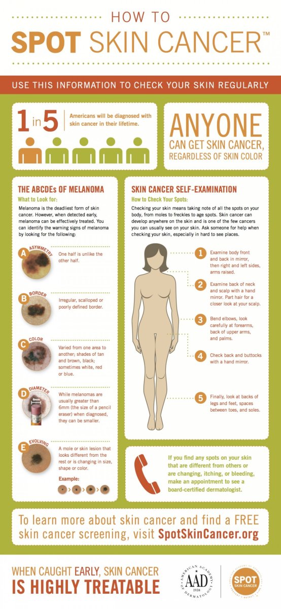 Infographic How To Check Yourself For Skin Cancer Opposing Views