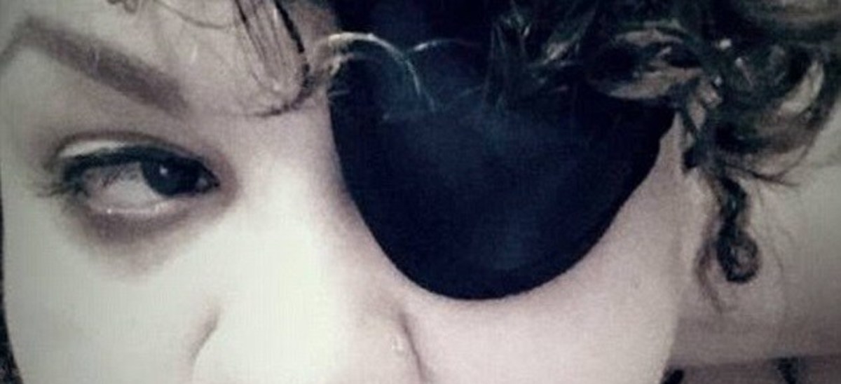 Woman Loses Eye After Glitter Accident Opposing Views