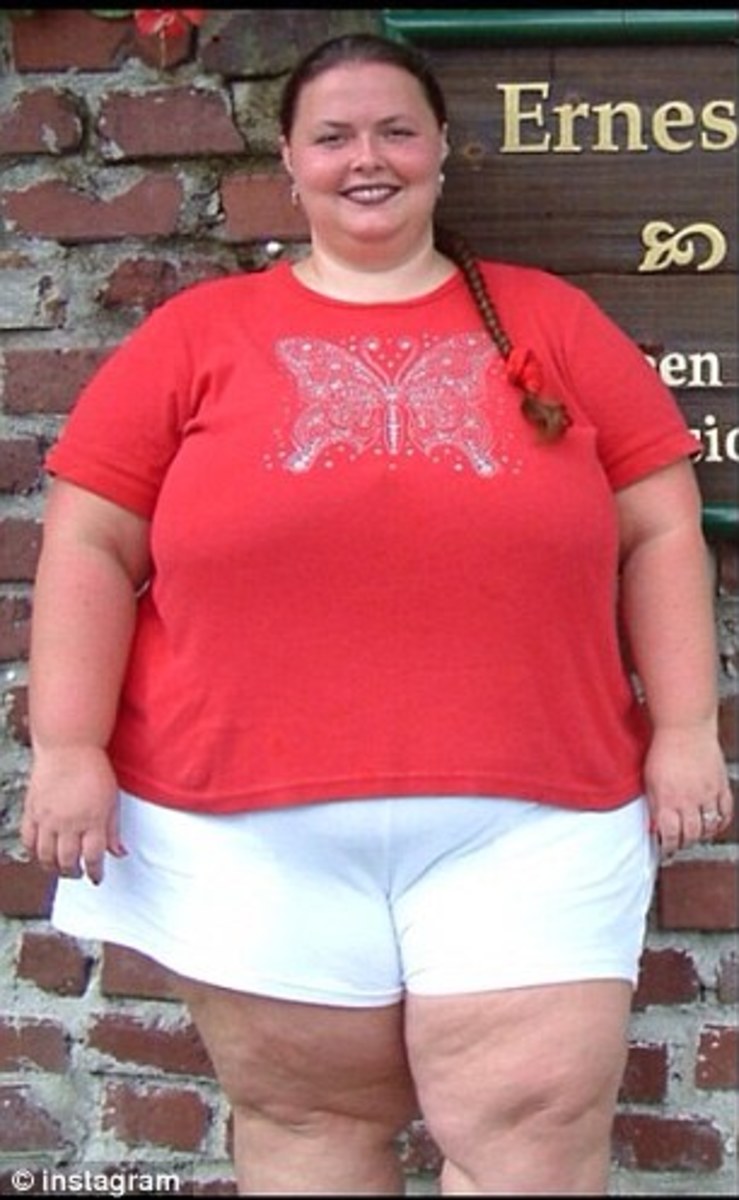Florida Woman Loses 150 Pounds In 2 Years (Photos) Opposing Views