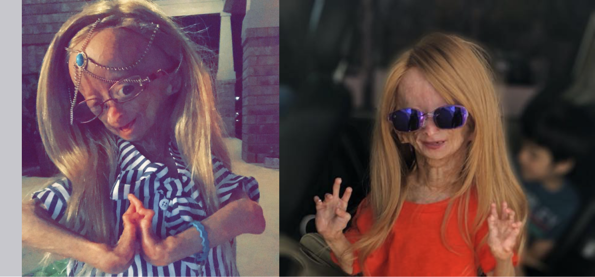 Here S How This 12 Year Old Is Overcoming Her Disease Despite All