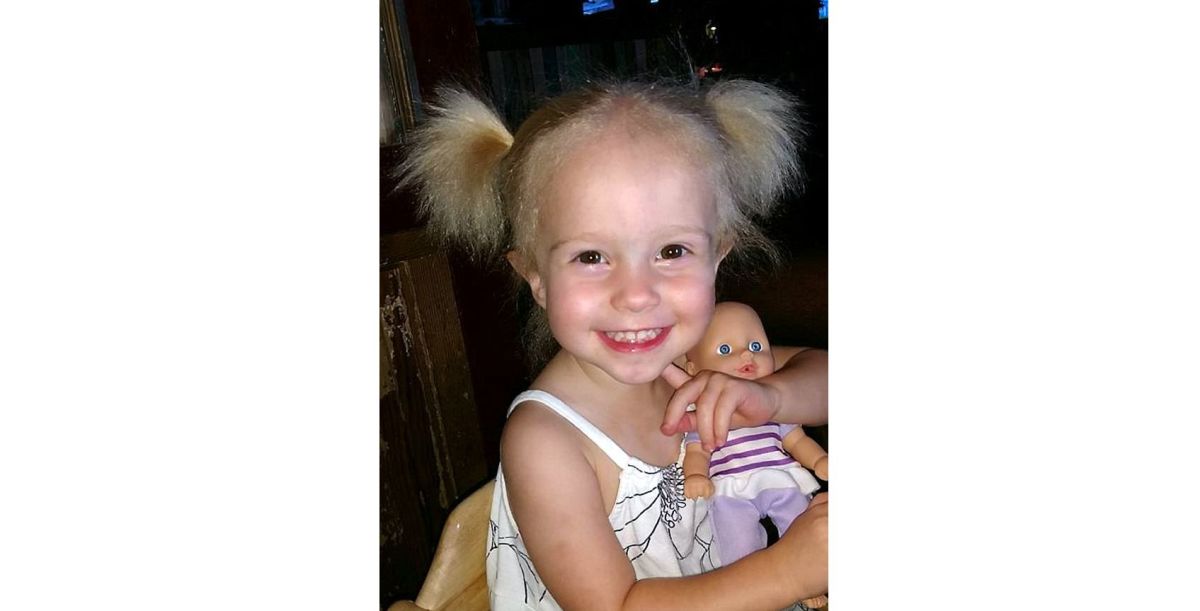 Girl's Unruly Hair Due To Rare Genetic Condition Einstein Had (Photos