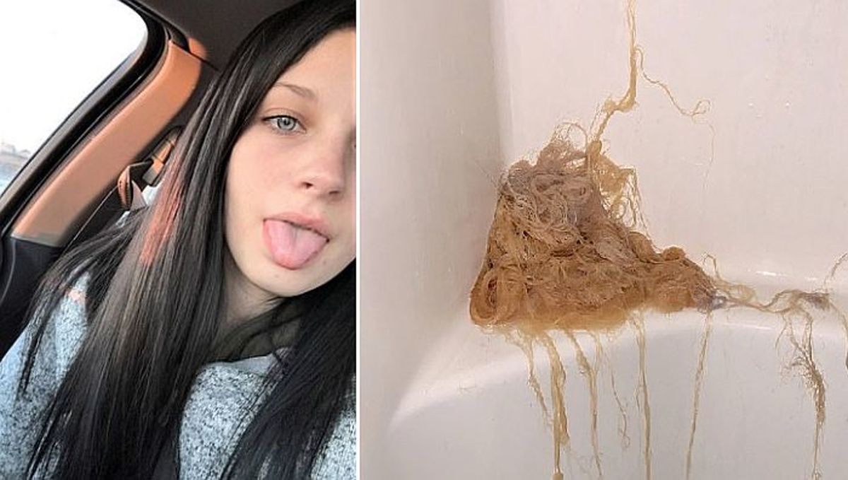Teen Girl Tries To Bleach Hair Then Things Take A Horrible Turn