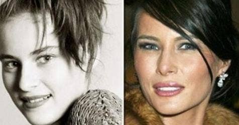 Old Pictures Of Melania Trump Resurface, Spark Online Debate About Her Appearance - Vimarsana News