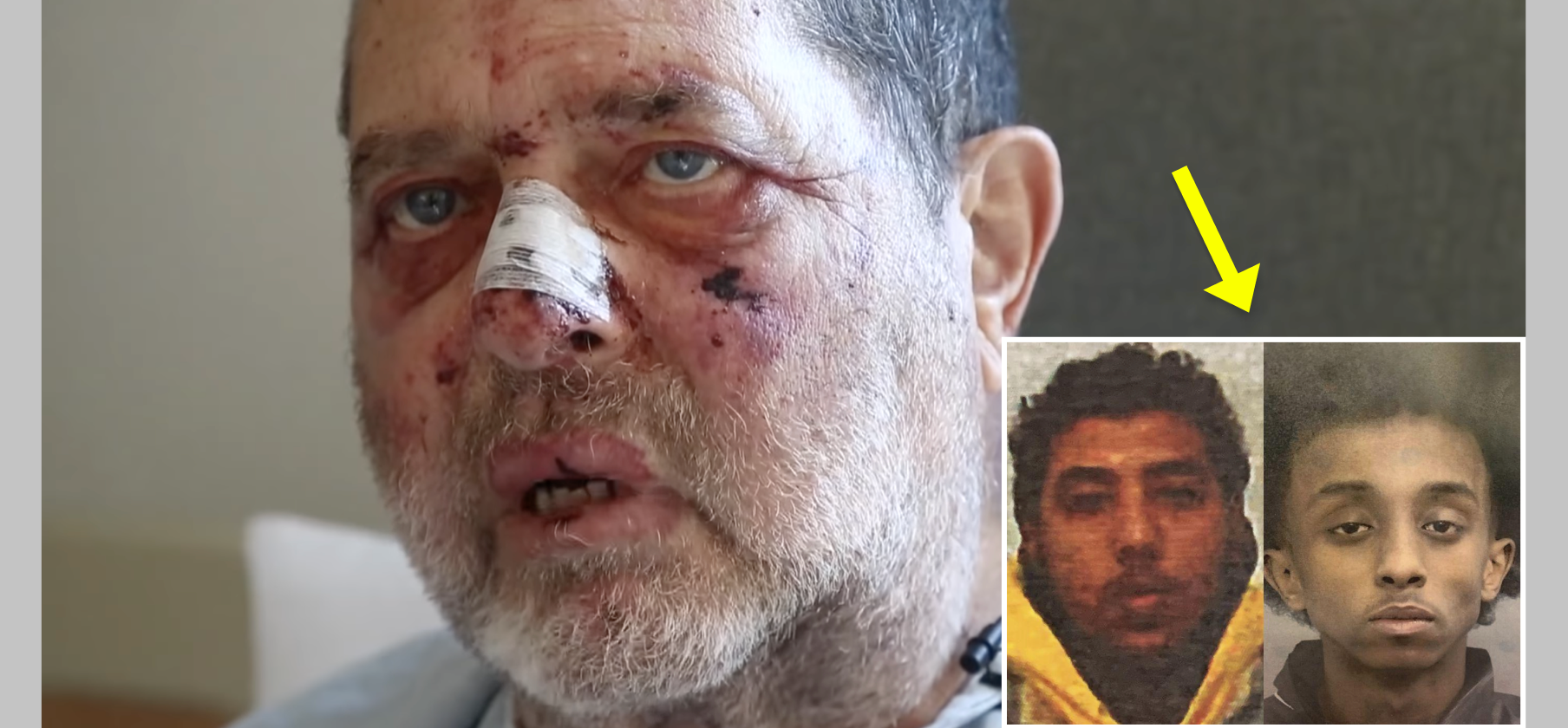 Elderly Man Beaten In Broad Daylight, Judge Reduces Attackers' Jail Time Because They 'Suffered' - Vimarsana News