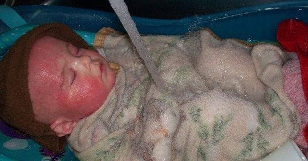Mother Finally Discovers What Was 'Melting' Her Child's Skin For The 1st Year Of His Life - Vimarsana News