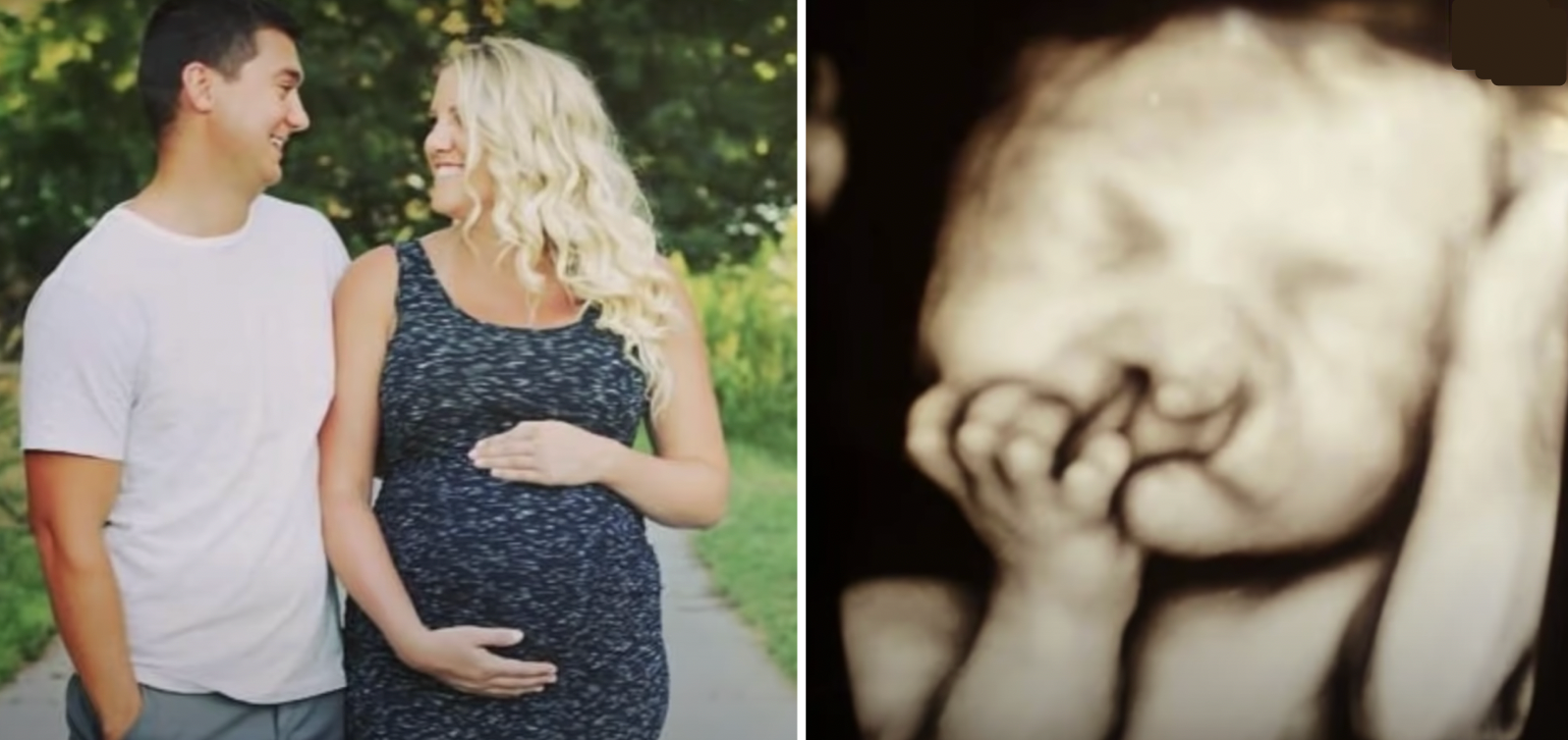 Parents Refuse To Abort Baby With 'Deformity' - Here's How He Looks A Few Years Later - Vimarsana News