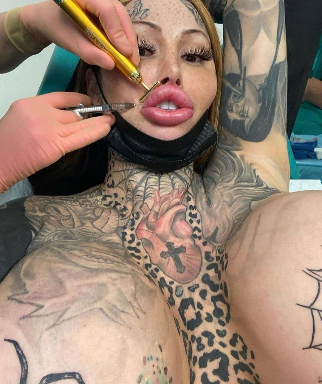 Selfie of Mary Magdalene in the middle of getting lip filler injected, Photo Credit: marysebastianpickles/Instagram