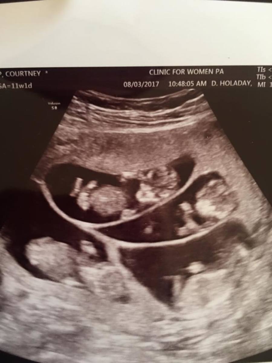 Ultrasound of sextuplets in the womb, Photo Credit: God's Divine Nine-Sweet Home Sextuplets/Facebook