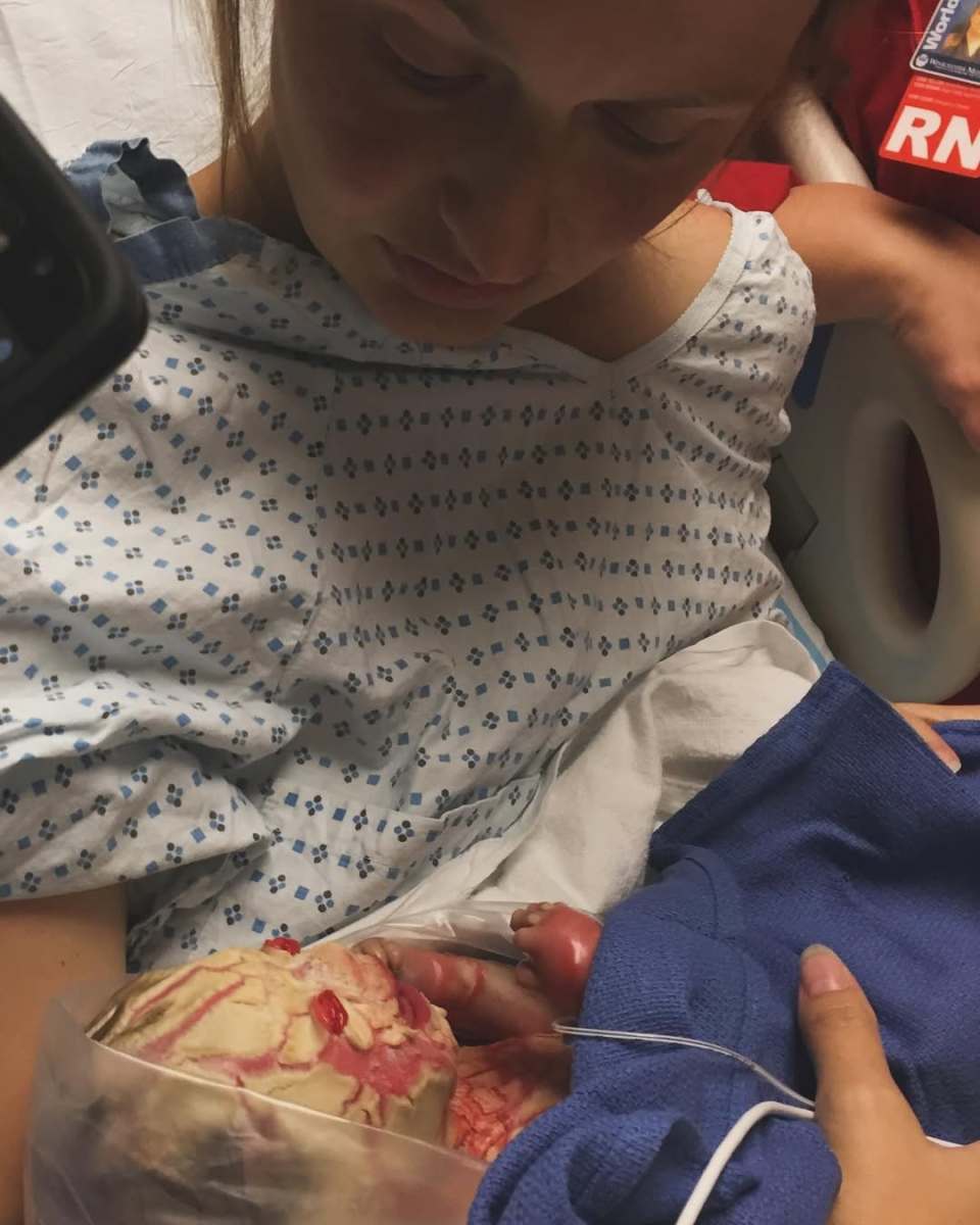 Newborn baby Anna with harlequin ichthyosis condition, Photo Credit: harlequindiva/Instagram