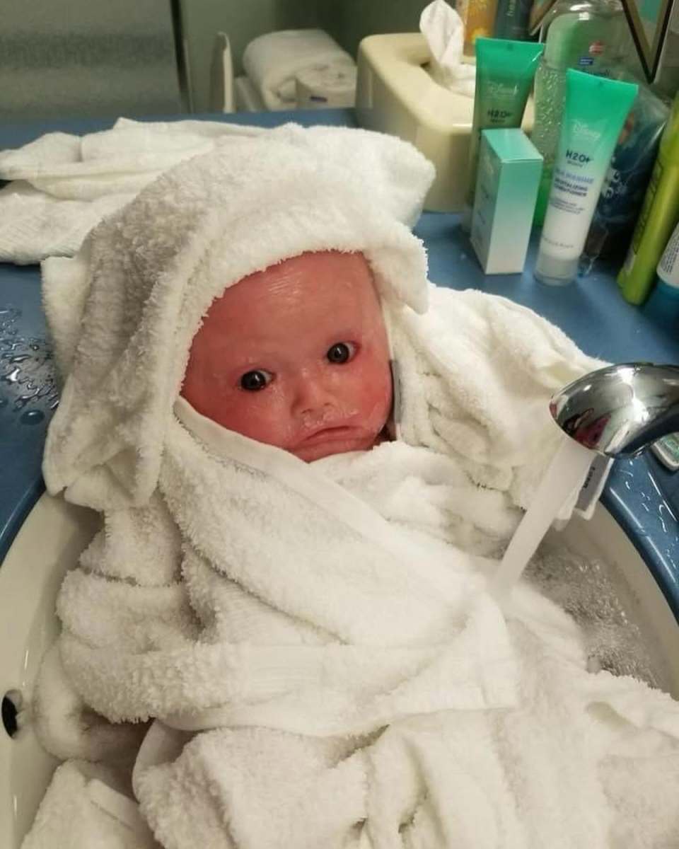 Baby Anna covered with white towel in a sink, Photo Credit: harlequindiva/Instagram