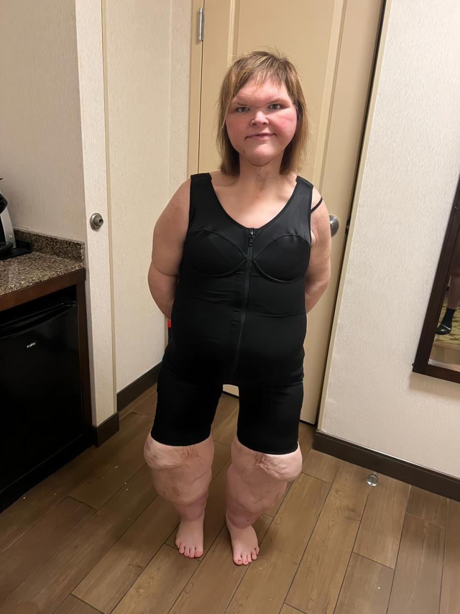 Tammy Slaton's dramatic weight loss transformation photo posted on Tiktok, Photo Credit: tammy.l.slaton/Tiktok