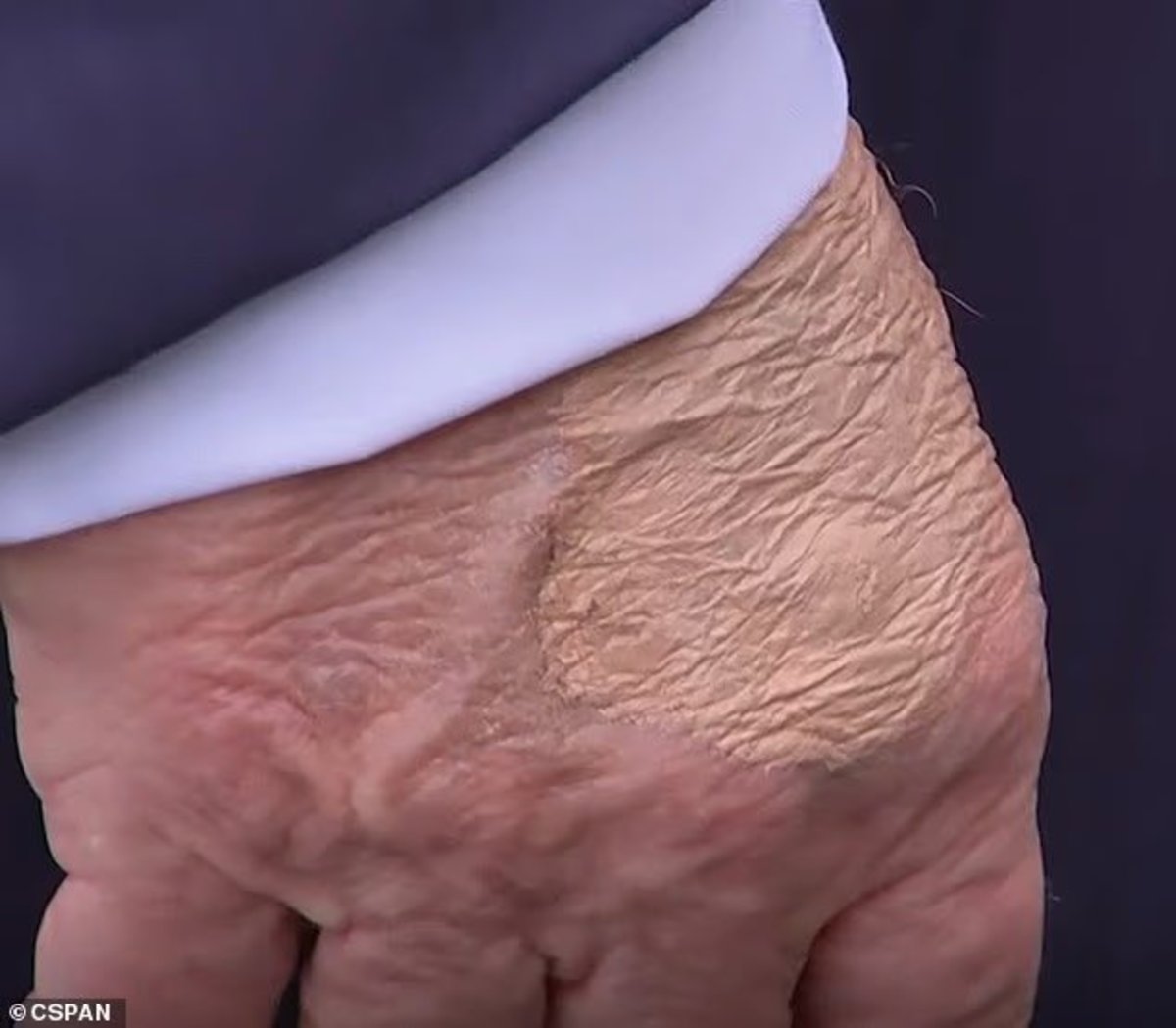 US President Donald Trump appears to have foundation makeup on his hand; Photo Credit: 4th Musketeer/X
