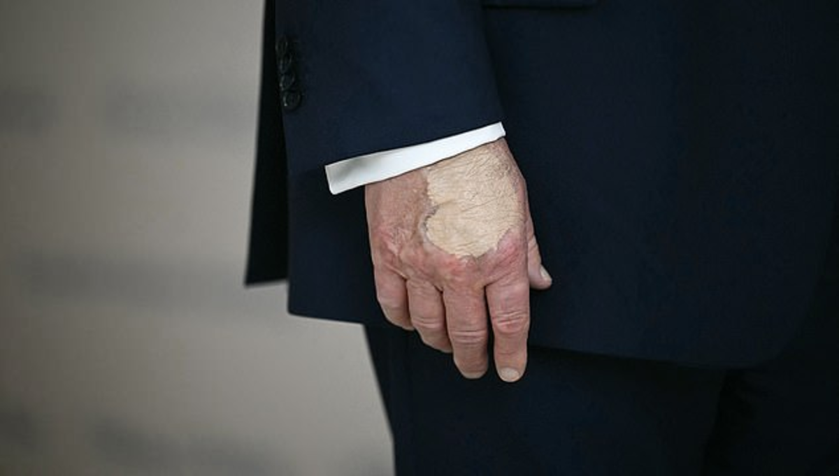 US President Donald Trump appears to have foundation makeup on his hand; Photo Credit: Molly Ploofkins/X