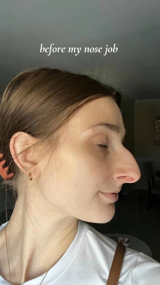 Devyn Aiken before getting a nose job, Photo Credit: doseofdevy/Tiktok