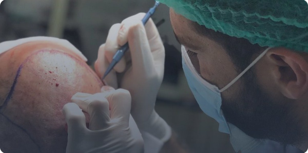 Surgeon giving a patient a hair transplant to their scalp, Photo Credit: wikimedia
