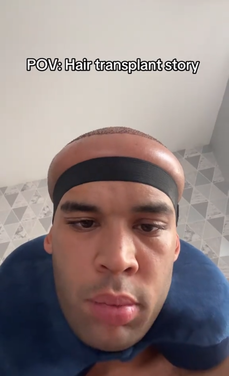 Kanah Flex looking into the camera with his head visibly swollen, Photo Credit: kanahflextv/Tiktok