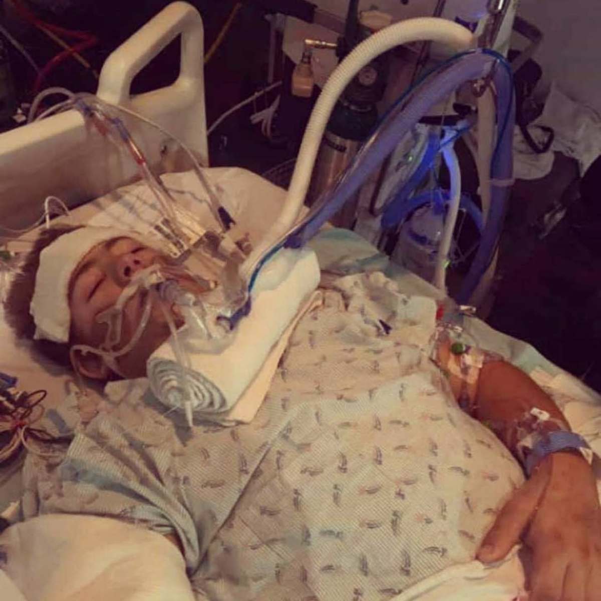 Loren lying in hospital bed 2 days after his forklift accident, Photo Credit: loren.schauers/Instagram