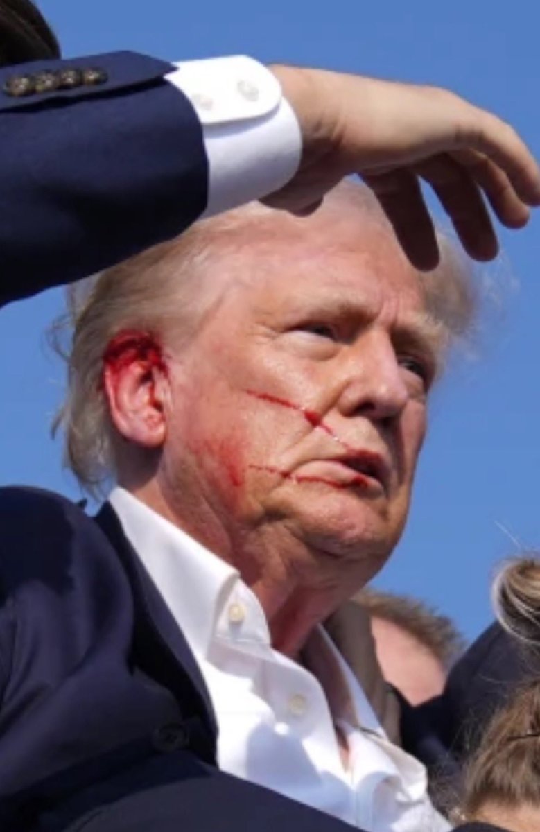 President Donald Trump with blood on his right ear and cheek following a shooting incident at a campaign rally in Butler, Pennsylvania, 2024, Photo Credit: DramaAlert/X
